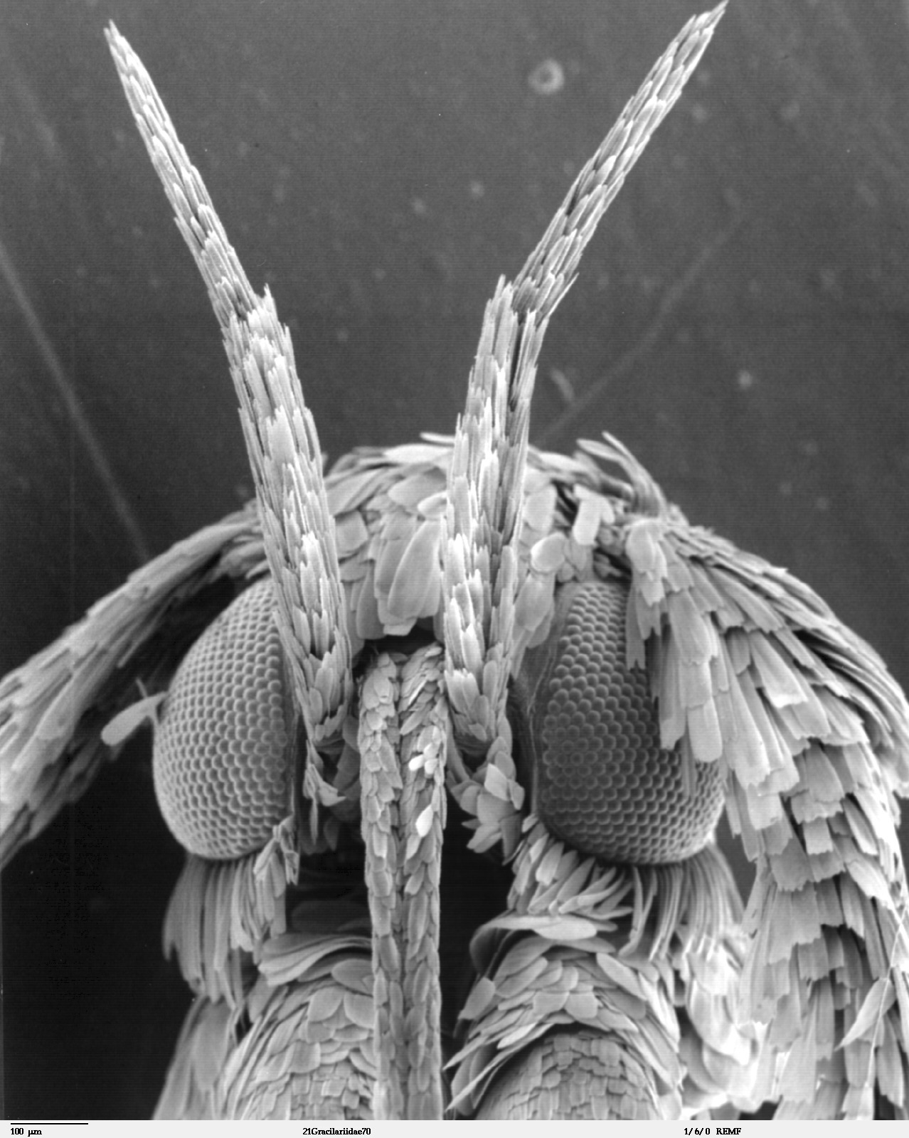 Cabeza de una polilla de la familia Gracillariidae al microscopio electrónico