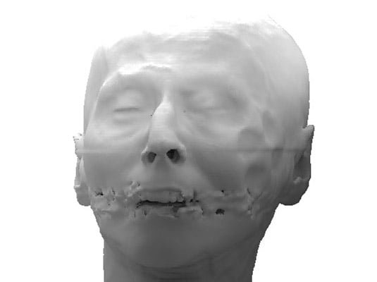 Cabeza humana renderizada en 3D a partir de vóxeles, con textura irregular en la zona de la boca