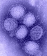 Virus H1N1 gripe A