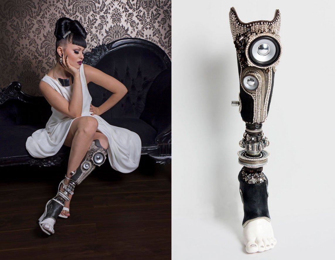 Stereo leg